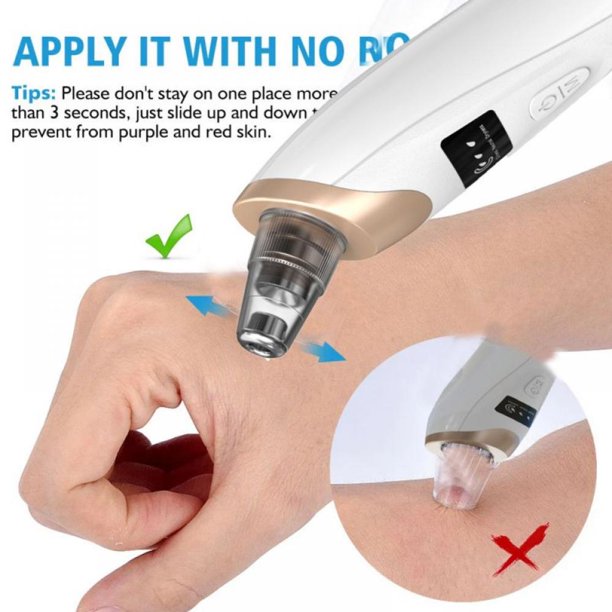 Electric Suction Blackhead Remover