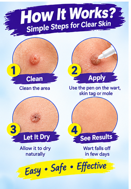 Wart Remover Gel Pen (Imported )