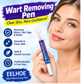 Wart Remover Gel Pen (Imported )