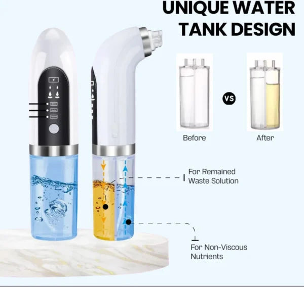 Bubble Facial & Blackhead Remover