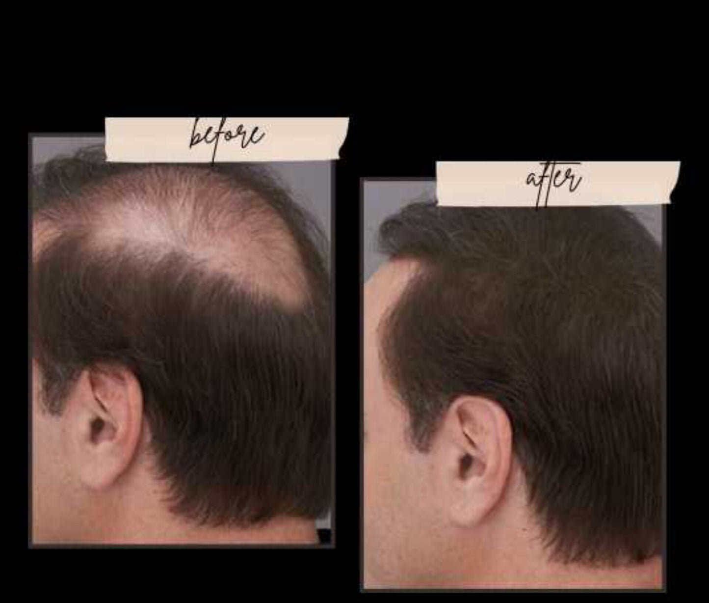 Hair Fiber Holding Spray (Imported)